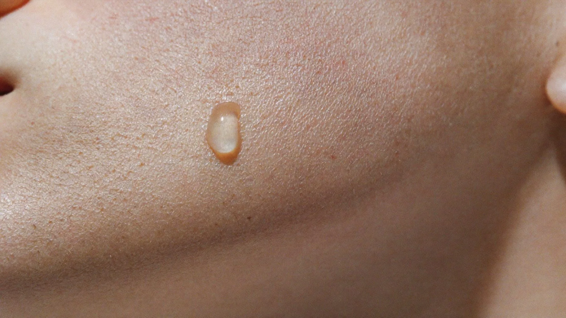 Macro photograph of skin texture